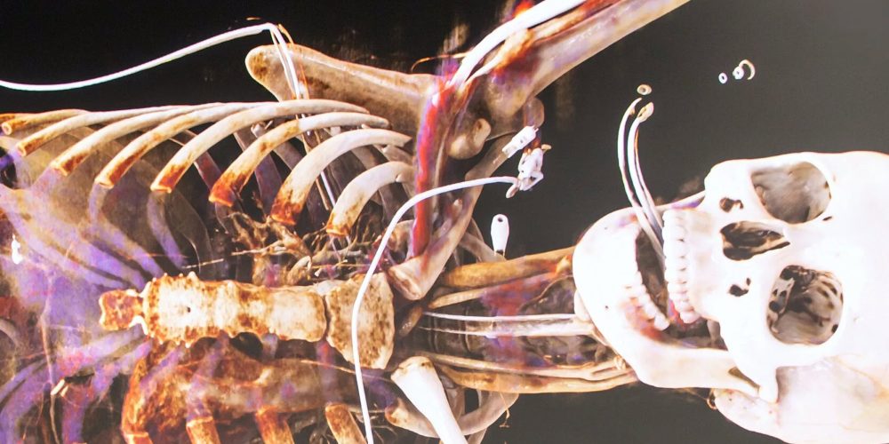 Jury honors anatomy education of the future